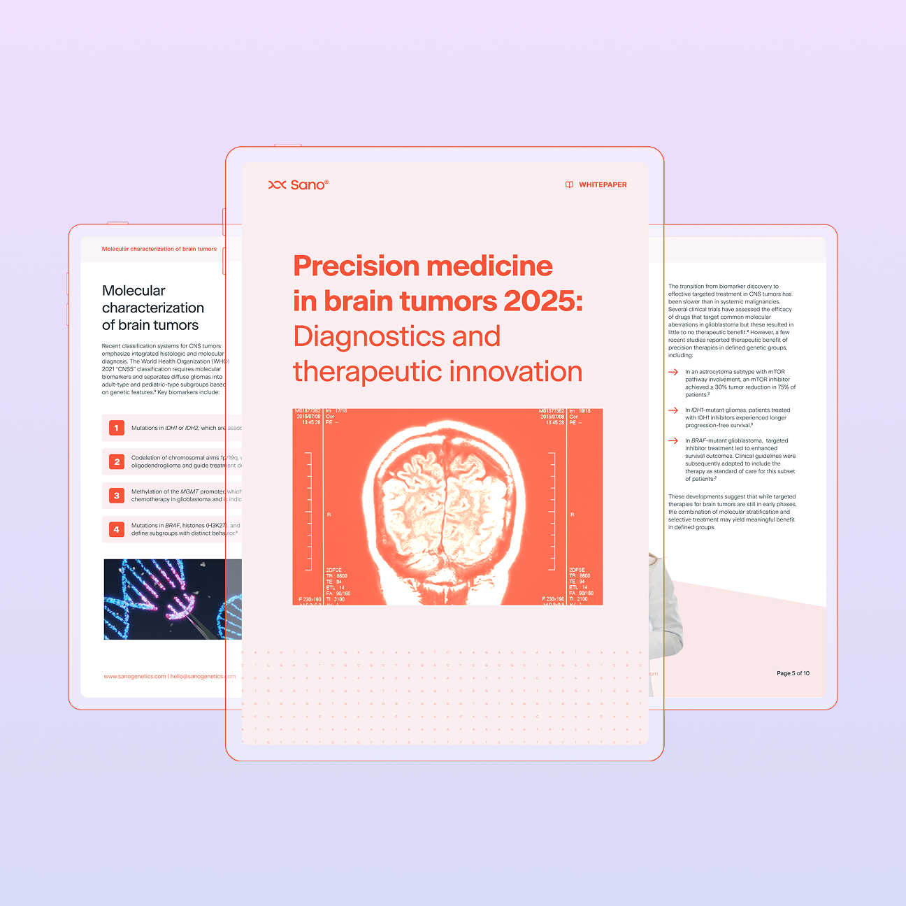 Precision medicine in brain tumors in 2025